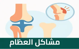 مشاكل العظام – الأسباب والأعراض وطرق العلاج مع د. ضياء السيد